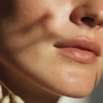 How to Repair Your Skin Barrier Naturally
